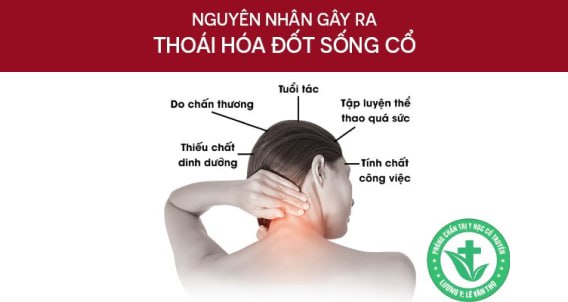 Chữa Thoái Hóa Đốt Sống Cổ Bằng Đông Y Ở Thanh Hóa