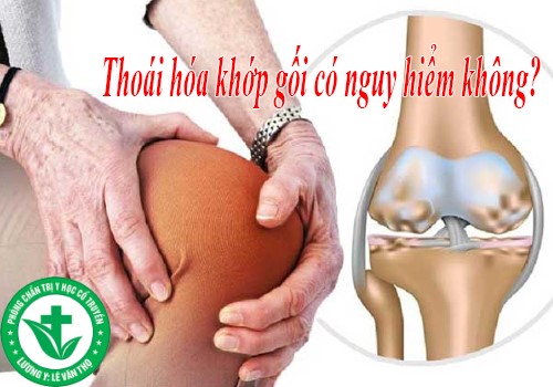 Chữa Thoái Hóa Khớp Gối Theo Y Học Cổ Truyền